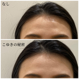 こゆきの秘密 / セクレット ドゥ コユキ