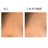 こゆきの秘密 / セクレット ドゥ コユキ