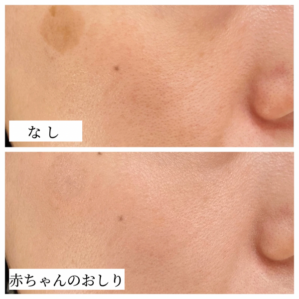 赤ちゃんのおしり / ﾌｪｽ ﾄﾞｩ ﾍﾞﾍﾞ